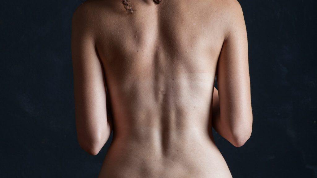 Les zones les plus populaires pour la cryolipolyse : où cibler les graisses tenaces